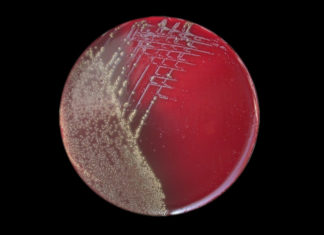 ANSA: vaccino pertosse causa contagio