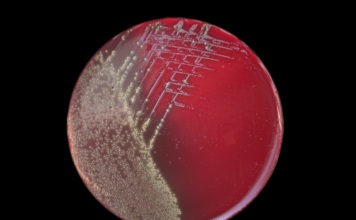 ANSA: vaccino pertosse causa contagio