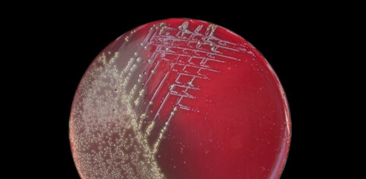 ANSA: vaccino pertosse causa contagio