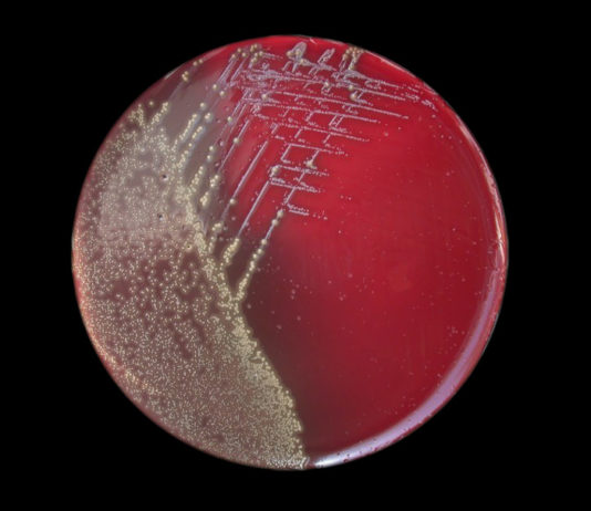 ANSA: vaccino pertosse causa contagio