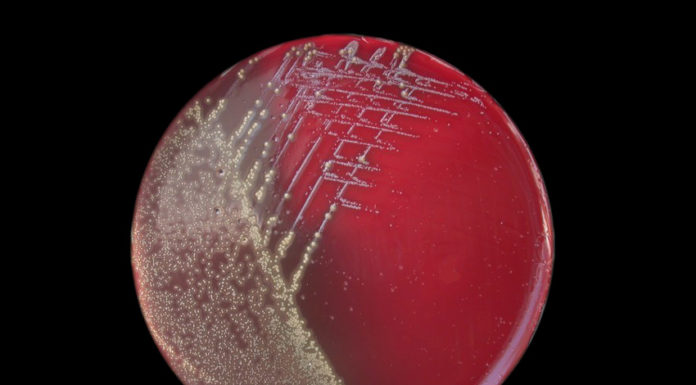 ANSA: vaccino pertosse causa contagio