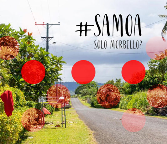 Epidemia di morbillo a Samoa: dengue, zika, chikungunya o rosolia?